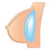 Cosdoll 等身大ラブドール 165cm Fカップ 巨乳 #23ヘッド sexリアルドール【軟性・硬性シリコンヘッド及ボディ選択可 カスタマイズ可】