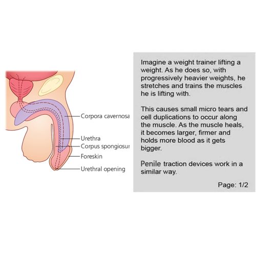 Adjustable Stretch Length Penis Extender for Men 