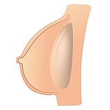 23ヘッド & 163cm F-cup シリコン頭部+TPEボディ Sanmudoll