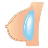 MOZU DOLL 魔族人形フィギュア 150cm 蕾雅ちゃん 15KG ソフトビニール製頭部 TPE製ボディ宣材写真と同じ 着せ替え人形 ラブドール